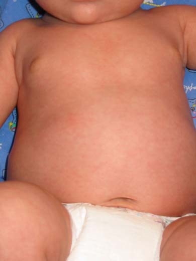 Buddha Belly -- 3/15/02